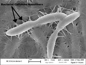 Read more about the article Proses Inokulasi Bakteri  Acetobacter Xylinum Untuk Pembuatan Nata